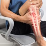 Broken Bone Accident Lawyers in San Antonio Texas