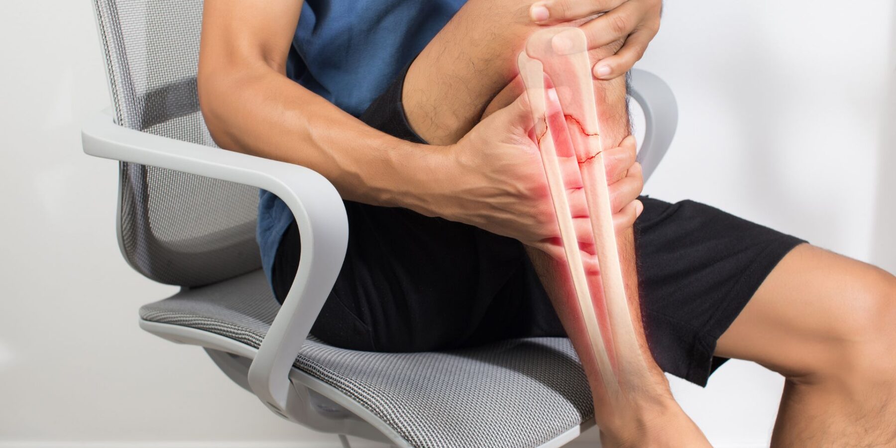 Broken Bone Accident Lawyers in San Antonio Texas