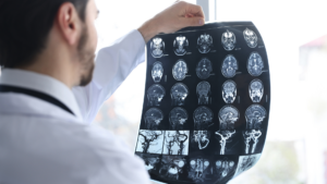 How a San Antonio Traumatic Brain Injury Lawyer Makes a Difference After a Serious Accident